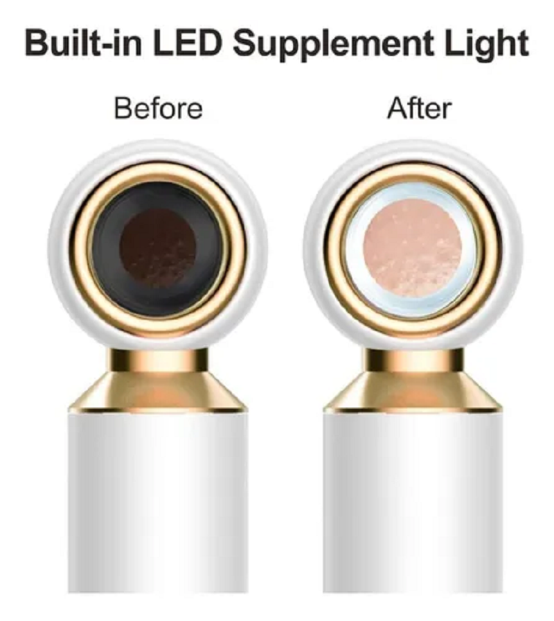 Miniatura 3 de Extractor De Puntos Negros Lupa